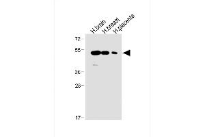All lanes : Anti-ENT1 Antibody (C-term) at 1:1000 dilution Lane 1: Human brain lysate Lane 2: Human breast lysate Lane 3: Human placenta lysate Lysates/proteins at 20 μg per lane. (SLC29A1 antibody  (C-Term))