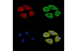 ABIN7095965 and ABIN7100027 staining Hela cells by IF/ICC. (SNX12 antibody)