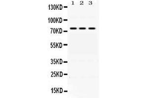 Western blot analysis of ACSL1 expression in rat liver extract ( Lane 1) HEPA whole cell lysates ( Lane 2) and A549 whole cell lysates ( Lane 3). (ACSL1 antibody  (AA 604-698))