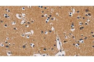 Immunohistochemistry of paraffin-embedded Human brain tissue using CBY1 Polyclonal Antibody at dilution 1:60 (CBY1/PGEA1 antibody)