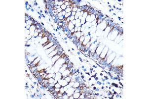 Immunohistochemistry of paraffin-embedded Human colon using CTGF Rabbit pAb (ABIN6127717, ABIN6139188, ABIN6139191 and ABIN6215222) at dilution of 1:100 (40x lens). (CTGF antibody  (AA 27-349))