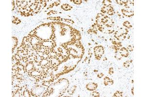 Immunohistochemistry (IHC) image for anti-Androgen Receptor (AR) (AA 1-50) antibody (ABIN7795785) (Recombinant Androgen Receptor antibody  (AA 1-50))