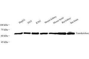 Western blot analysis of Transketoluse (ABIN7075978) at dilution of 1: 500 (TKT antibody)