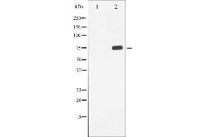 Western blot analysis of Tau phosphorylation expression in HeLa whole cell lysates,The lane on the left is treated with the antigen-specific peptide. (MAPT antibody  (pSer214))