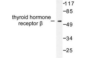 Image no. 1 for anti-Thyroid Hormone Receptor, beta (THRB) antibody (ABIN271853) (THRB antibody)