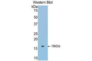 Western Blotting (WB) image for anti-serpin Peptidase Inhibitor, Clade A (Alpha-1 Antiproteinase, Antitrypsin), Member 6 (SERPINA6) (AA 268-391) antibody (ABIN1858272) (SERPINA6 antibody  (AA 268-391))