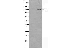 Western blot analysis on HeLa cell lysate using RON Antibody. (MST1R antibody  (C-Term))