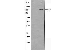 Western blot analysis on HeLa cell lysate using RON Antibody.