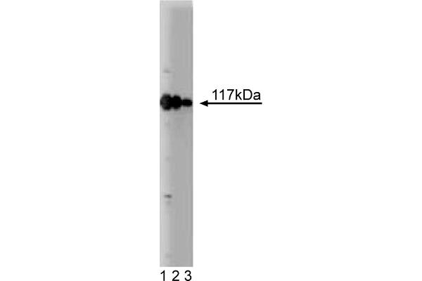 RABEP1 anticorps  (AA 247-417)