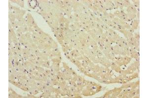 Immunohistochemistry of paraffin-embedded human heart tissue using ABIN7147350 at dilution of 1:100 (Centrin 1 antibody  (AA 1-172))