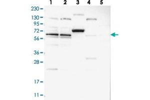 Western blot analysis of Lane 1: RT-4, Lane 2: U-251 MG, Lane 3: Human Plasma, Lane 4: Liver, Lane 5: Tonsil with ZNF324B polyclonal antibody  at 1:250-1:500 dilution.