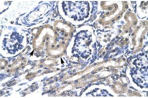 Human kidney; TRAFD1 antibody - C-terminal region in Human kidney cells using Immunohistochemistry (TRAFD1 antibody  (C-Term))