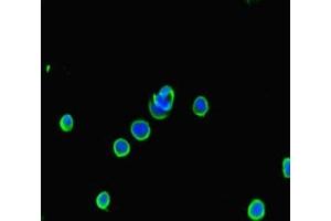 Immunofluorescent analysis of MCF-7 cells using ABIN7145091 at dilution of 1:100 and Alexa Fluor 488-congugated AffiniPure Goat Anti-Rabbit IgG(H+L) (ATG5 antibody  (AA 5-272))