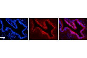 Immunohistochemistry (IHC) image for anti-Uridine Monophosphate Synthetase (UMPS) (C-Term) antibody (ABIN2783243)