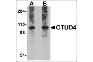 Western blot analysis of OTUD4 in Daudi cell lysate with this product at (A) 0.