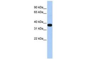 Image no. 1 for anti-Mitochondrial E3 Ubiquitin Protein Ligase 1 (MUL1) (AA 216-265) antibody (ABIN6740814) (MUL1 antibody  (AA 216-265))