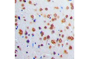 Immunohistochemical analysis of Adenylate Cyclase 1 staining in human brain formalin fixed paraffin embedded tissue section. (ADCY1 antibody  (Center))