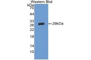 Detection of Recombinant GP5, Human using Polyclonal Antibody to Cluster of Differentiation 42d (CD42d) (GP5 antibody  (AA 17-242))