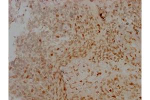 Immunohistochemistry (IHC) image for anti-Aurora Kinase B (AURKB) antibody (ABIN7127357)