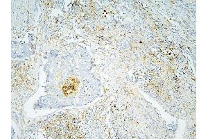 IHC analysis of ANXA3 using anti-ANXA3 antibody (ABIN6719269). (Annexin A3 antibody  (AA 23-323))