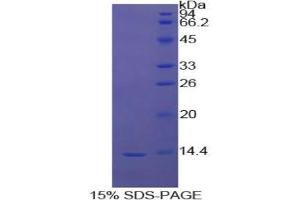SDS-PAGE analysis of Cow Myostatin Protein. (MSTN Protein)