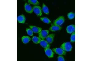 IF analysis of DDX3/DDX3X using anti-DDX3/DDX3X antibody (ABIN7603211). (DDX3X antibody  (N-Term))