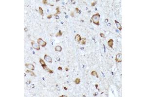 Immunohistochemistry of paraffin-embedded rat brain using BNIP1 Rabbit mAb (ABIN7265867) at dilution of 1:100 (40x lens). (BNIP1 antibody)