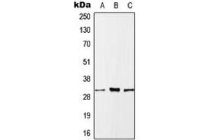 Western blot analysis of MLF1 expression in HeLa (A), SP2/0 (B), H9C2 (C) whole cell lysates. (MLF1 antibody  (Center))