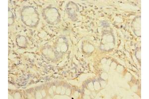 Immunohistochemistry of paraffin-embedded human small intestine tissue using ABIN7161555 at dilution of 1:100 (NHLRC2 antibody  (AA 1-367))