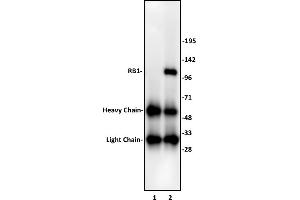 RB1 antibody (pAb) tested by Immunoprecipitation. (Retinoblastoma 1 antibody  (C-Term))
