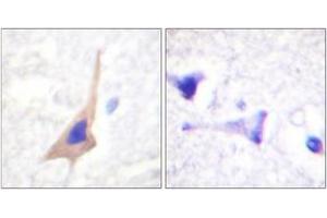 Immunohistochemistry analysis of paraffin-embedded human brain, using Tryptophan Hydroxylase (Phospho-Ser58) Antibody. (Tryptophan Hydroxylase 1 antibody  (pSer58))