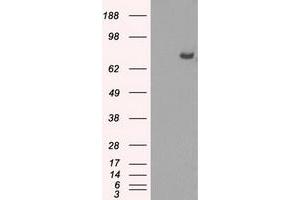 Image no. 15 for anti-P450 (Cytochrome) Oxidoreductase (POR) antibody (ABIN1497746) (POR antibody)