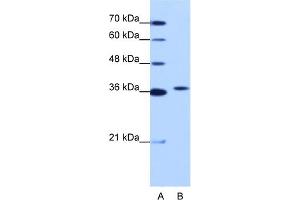 WB Suggested Anti-EXOSC7 Antibody Titration:  1. (EXOSC7 antibody  (N-Term))