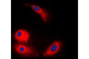 Immunofluorescent analysis of ARMC6 staining in COLO205 cells. (ARMC6 antibody  (C-Term))