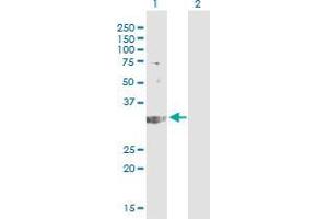 Western Blot analysis of TREX1 expression in transfected 293T cell line by TREX1 monoclonal antibody (M01), clone 2F10. (TREX1 antibody  (AA 1-100))