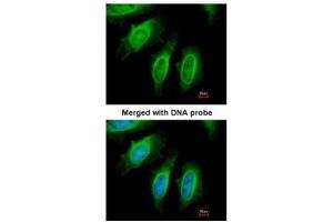 ICC/IF Image Immunofluorescence analysis of paraformaldehyde-fixed HeLa, using SH3GL1, antibody at 1:200 dilution. (SH3GL1 antibody  (Center))