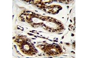 Nucleolin antibody immunohistochemistry analysis in formalin fixed and paraffin embedded human breast tissue. (Nucleolin antibody)