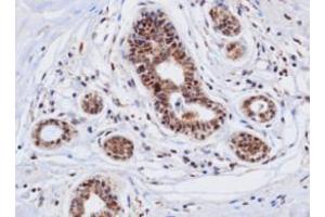 Immunohistochemistry (IHC) image for anti-Cathepsin D (CTSD) (AA 21-412) antibody (ABIN317502) (Cathepsin D antibody  (AA 21-412))