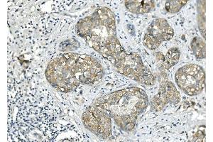 IHC analysis of BubR1/BUB1B using anti-BubR1/BUB1B antibody (ABIN7600960).