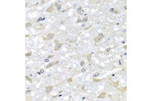 Immunohistochemistry of paraffin-embedded rat brain using RPLP1 antibody at dilution of 1:100 (x40 lens). (RPLP1 antibody)