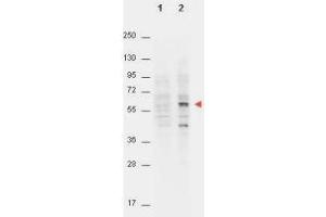 Western Blot of Mouse anti-AKT pT308 antibody. (AKT1 antibody  (pThr308))