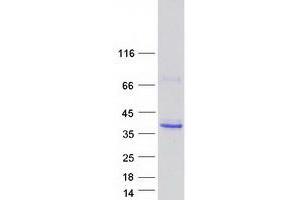 Validation with Western Blot (Ficolin 2 Protein (Myc-DYKDDDDK Tag))