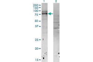 Western Blot analysis of IL18RAP expression in transfected 293T cell line by IL18RAP monoclonal antibody (M04), clone 4G4. (IL18RAP antibody  (AA 20-129))