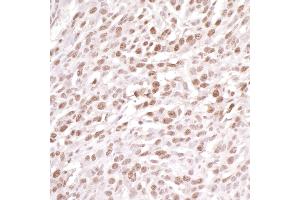 Immunohistochemistry (IHC) image for anti-Damage Specific DNA Binding Protein 1 (DDB1) (C-Term) antibody (ABIN7454634) (DDB1 antibody  (C-Term))