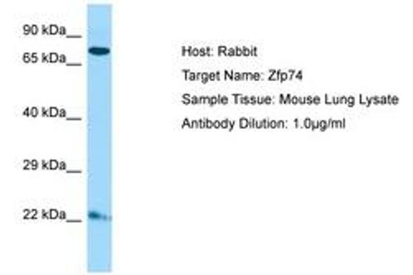 ZNF569 antibody  (C-Term)