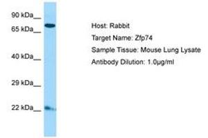 Image no. 1 for anti-Zinc Finger Protein 569 (ZNF569) (C-Term) antibody (ABIN6749864) (ZNF569 antibody  (C-Term))