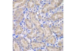 Immunohistochemistry of paraffin-embedded mouse kidney using ASPSCR1 antibody.