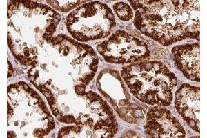 ABIN6277332 at 1/100 staining human kidney tissue sections by IHC-P. (TRAP1 antibody  (Internal Region))