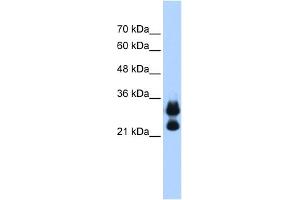 WB Suggested Anti-HIST1H1C Antibody Titration:  0. (HIST1H1C antibody  (Middle Region))