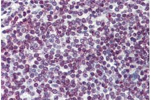 Human Spleen: Formalin-Fixed, Paraffin-Embedded (FFPE) (FOXO3 antibody  (AA 361-460))